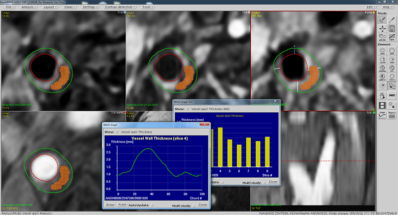 medis medical imaging systems